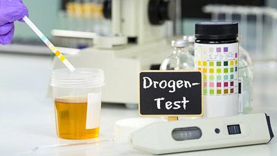 In einem Labor wird eine Urinprobe auf Drogenrückstände geprüft.